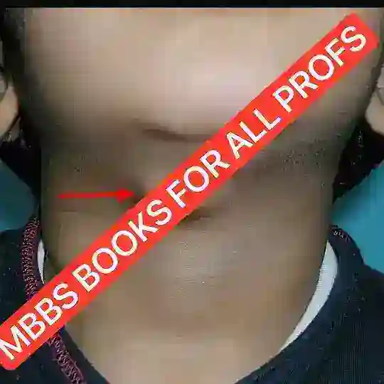 MBBS BOOK PDFs Telegram channel
