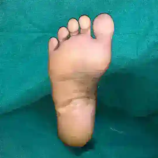 Diabetic Foot Surgery Group